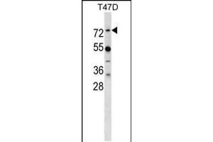 Western blot analysis in T47D cell line lysates (35ug/lane). (MX1 Antikörper  (AA 409-437))