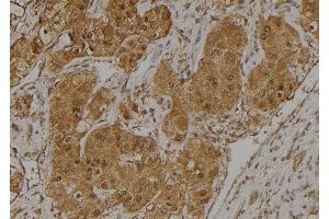 ABIN6275025 at 1/100 staining Human kidney tissue by IHC-P. (CCDC102B Antikörper  (Internal Region))