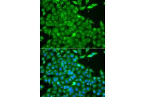 Immunofluorescence analysis of A549 cells using CSNK1G2 antibody. (Casein Kinase 1 gamma 2 Antikörper)