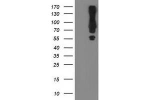 Western Blotting (WB) image for anti-Mahogunin, Ring Finger 1 (MGRN1) antibody (ABIN1499457) (Mahogunin RING Finger Protein 1 Antikörper)
