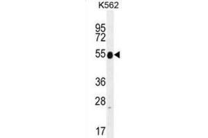 Western Blotting (WB) image for anti-Keratin 25 (KRT25) antibody (ABIN2996108) (Keratin 25 Antikörper)