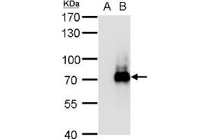 WB Image TRIM32 antibody detects TRIM32 protein by western blot analysis. (TRIM32 Antikörper)