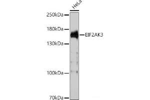 Western blot analysis of extracts of HeLa cells using EIF2AK3 Polyclonal Antibody at dilution of 1:1000. (PERK Antikörper)