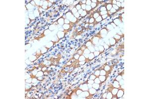 Immunohistochemistry of paraffin-embedded human colon using HHL antibody (ABIN6132190, ABIN6141750, ABIN6141751 and ABIN6217197) at dilution of 1:100 (40x lens). (HHLA2 Antikörper  (AA 30-200))