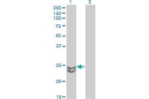 Western Blotting (WB) image for anti-RAB27A, Member RAS Oncogene Family (RAB27A) (AA 122-222) antibody (ABIN598569) (RAB27A Antikörper  (AA 122-222))