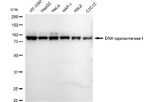 anti-Topoisomerase (DNA) I (TOP1) antibody