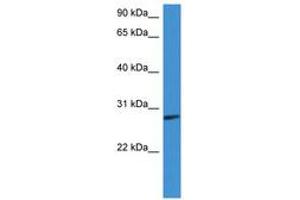 Image no. 1 for anti-Complement Factor D (CFD) (AA 160-209) antibody (ABIN6746774) (Adipsin Antikörper  (AA 160-209))