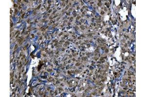 IHC analysis of Ki67/MKI67 using anti-Ki67/MKI67 antibody (ABIN7601873).