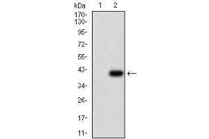 Western Blotting (WB) image for anti-ATP-Binding Cassette, Sub-Family B (MDR/TAP), Member 1 (ABCB1) (AA 632-693) antibody (ABIN1724923)