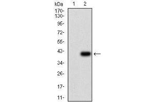 Western blot analysis using ABCB1 mAb against HEK293 (1) and ABCB1 (AA: 632-693)-hIgGFc transfected HEK293 (2) cell lysate. (ABCB1 Antikörper  (AA 632-693))