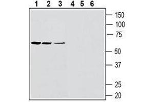 Western blot analysis of rat spleen lysates (lanes 1 and 4), rat lung membranes (lanes 2 and 4) and mouse lung membranes (lanes 3 and 6): - 1-3. (SLC11A1 Antikörper  (4th Extracellular Loop))