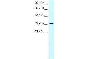 WB Suggested Anti-SNAPC2 Antibody Titration:  0. (SNAPC2 Antikörper  (Middle Region))