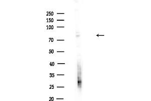 anti-Golgi Integral Membrane Protein 4 (GOLIM4) (Internal Region) antibody
