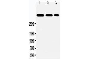 Anti-Laminin 2 alpha antibody, Western blotting Lane 1: HELA Cell Lysate Lane 2: A549 Cell Lysate Lane 3: PANC Cell Lysate (Laminin Antikörper  (N-Term))