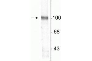 Western blot of a rat hippocampal lysate showing the specific immunolabeling of the ~100 kDa GluR2 protein. (GRIA2 Antikörper)