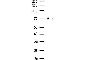 anti-ADP-Ribosylation Factor GTPase Activating Protein 3 (ARFGAP3) (C-Term) antibody