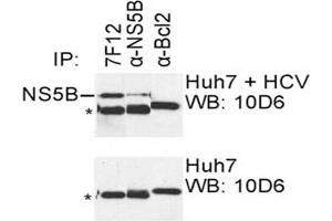 IP was carried out with NS5B specific mAb 7F12 using the lysates of Huh7 cells harboring selectable subgenomic HCV RNA replicon (upper panel) or plain Huh7 cells (lower panel). (HCV 1b NS5B Antikörper  (AA 77-86))