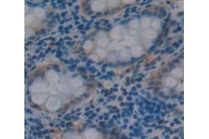 Figure. (CLCA1 Antikörper  (AA 416-670))