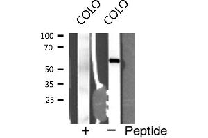 Western blot analysis of Interleukin 2 receptor β expression in COLO cells (IL2 Receptor beta Antikörper  (N-Term))