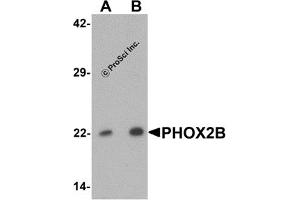 Western Blotting (WB) image for anti-Paired-Like Homeobox 2b (PHOX2B) (Middle Region) antibody (ABIN1031037) (PHOX2B Antikörper  (Middle Region))