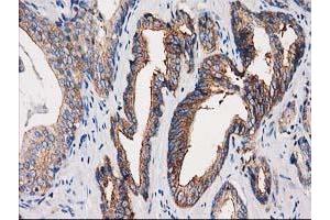 Image no. 3 for anti-Protein Kinase C and Casein Kinase Substrate in Neurons 3 (PACSIN3) antibody (ABIN1500007) (PACSIN3 Antikörper)