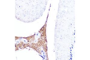 Immunohistochemistry of paraffin-embedded mouse testis using AMH Rabbit pAb (ABIN7265629) at dilution of 1:25 (40x lens). (AMH Antikörper  (AA 20-280))