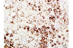 Formalin-fixed and paraffin embedded mouse melanoma labeled with Anti-Melanoma HMB45/Melanoma/Melan-A/MART-1 Polyclonal Antibody, Unconjugated  at 1:200 followed by conjugation to the secondary antibody and DAB staining. (MLANA Antikörper  (AA 51-118))