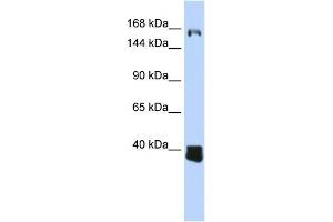 WB Suggested Anti-C10orf12 Antibody Titration: 0. (Lcor Antikörper  (Middle Region))