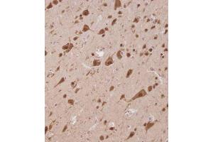 Immunohistochemistry (Paraffin-embedded Sections) (IHC (p)) image for anti-ELAV (Embryonic Lethal, Abnormal Vision, Drosophila)-Like 2 (Hu Antigen B) (ELAVL2) (AA 156-184) antibody (ABIN656861)