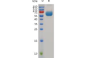 SDS-PAGE (SDS) image for Hepatitis A Virus Cellular Receptor 2 (TIM 3) (AA 20-192) protein (Fc Tag) (ABIN7491049)