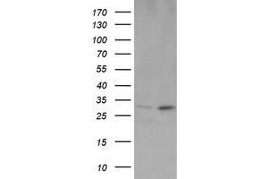 Image no. 2 for anti-OTU Domain, Ubiquitin Aldehyde Binding 1 (OTUB1) antibody (ABIN1499932) (OTUB1 Antikörper)