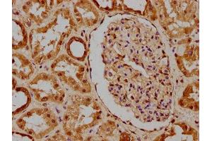 IHC image of ABIN7169084 diluted at 1:300 and staining in paraffin-embedded human kidney tissue performed on a Leica BondTM system. (PKN3 Antikörper  (AA 1-252))
