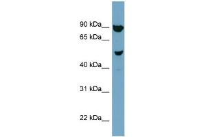 WB Suggested Anti-IRX2 Antibody Titration:  0. (IRX2 Antikörper  (N-Term))