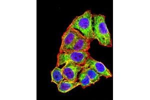 Immunofluorescence analysis of Hela cells using ALB mouse mAb (green). (Albumin Antikörper  (AA 410-609))