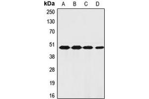 Western blot analysis of PAR1 expression in PaCa2 (A), HeLa (B), TF1 (C), ECV304 (D) whole cell lysates.