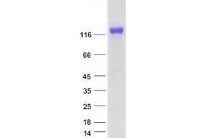 Validation with Western Blot (CD21 Protein (Transcript Variant 2) (Myc-DYKDDDDK Tag))