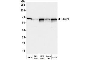 Western Blotting (WB) image for anti-Retinoblastoma Binding Protein 5 (RBBP5) (C-Term) antibody (ABIN7449051) (RBBP5 Antikörper  (C-Term))