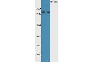 Lane 1:mouse brain lysate probed with Rabbit Anti-BMP1 Polyclonal Antibody, Unconjugated (ABIN873233) at 1:300 overnight at 4 °C. (BMP1 Antikörper)