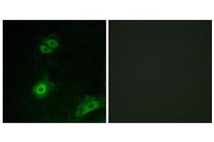 Immunofluorescence analysis of A549 cells, using OR4A16 antibody. (OR4A16 Antikörper  (C-Term))