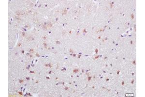 Formalin-fixed and paraffin embedded rat brain labeled with Rabbit Anti-NOX2/gp91phox Polyclonal Antibody, Unconjugated  at 1:200 followed by conjugation to the secondary antibody and DAB staining (CYBB Antikörper  (AA 501-570))