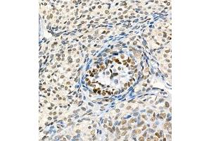Immunohistochemistry of paraffin embedded rat ovary using Skar (ABIN7074970) at dilution of 1:900 (400x lens) (p46 Antikörper)