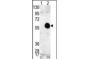Western blot analysis of AKT2 (arrow) using AKT2 Antibody (C-term) (ABIN391022 and ABIN2841192). (AKT2 Antikörper  (C-Term))