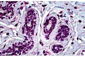 Human Breast: Formalin-Fixed, Paraffin-Embedded (FFPE) (RUNX1 Antikörper  (AA 210-311))