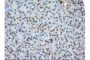 Immunohistochemical staining of paraffin-embedded Human Kidney tissue using anti-PFN1 mouse monoclonal antibody. (PFN1 Antikörper)