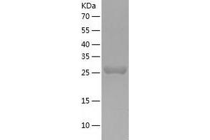 CutC Copper Transporter Homolog (CUTC) (AA 1-273) protein (His-IF2DI Tag)
