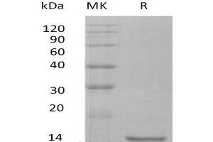 Western Blotting (WB) image for Interleukin 10 (IL10) protein (ABIN7320571) (IL-10 Protein)