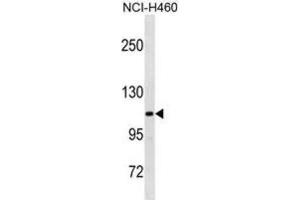 Western Blotting (WB) image for anti-Thrombospondin 4 (THBS4) antibody (ABIN3001104)