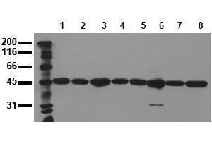 Western Blotting (WB) image for anti-Mitogen-Activated Protein Kinase Kinase 2 (MAP2K2) antibody (ABIN126838) (MEK2 Antikörper)