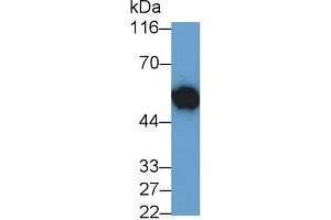 Detection of MYC in HL60 cell lysate using Polyclonal Antibody to V-Myc Myelocytomatosis Viral Oncogene Homolog (MYC) (LMYC Antikörper  (AA 186-439))