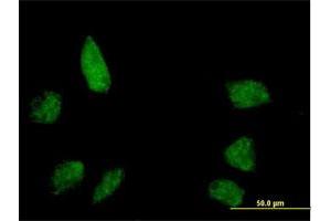 Immunofluorescence of purified MaxPab antibody to BANP on HeLa cell.